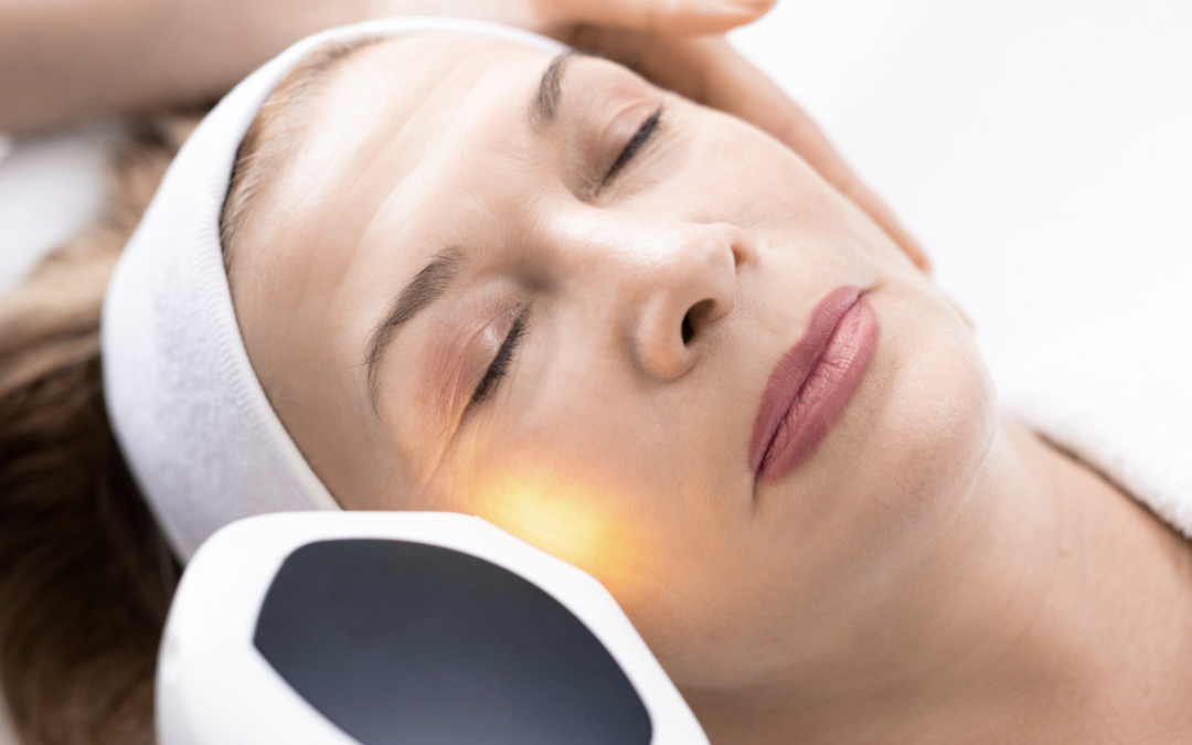 Laser Resurfacing Pricing in Potomac, Maryland for Fine Lines and Wrinkles